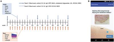 IMPROVE 1.0: Individual Monitoring of Psoriasis Activity by Regular Online App Questionnaires and Outpatient Visits